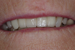 orthodontist Salisbury